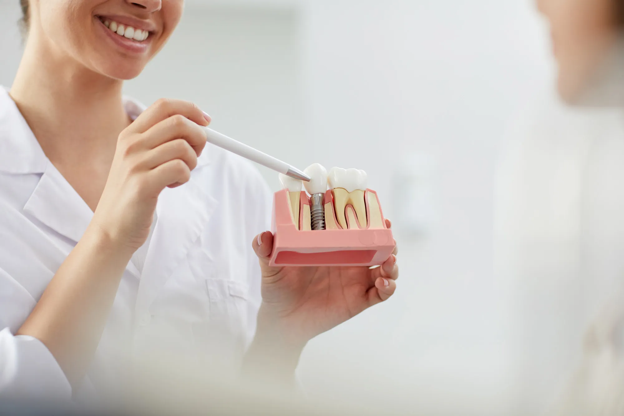 dental implants in regina