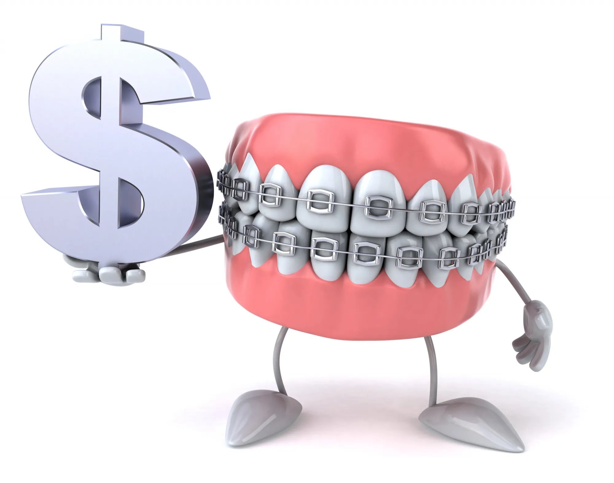 dental veneers expenses