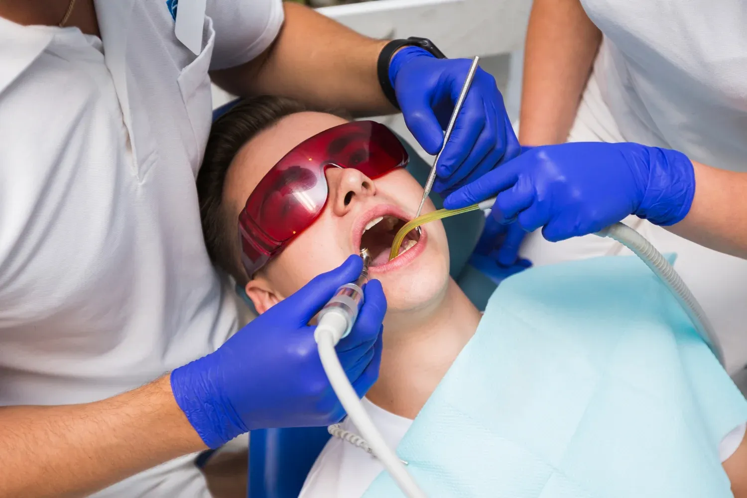 emergency wisdom teeth removal in regina