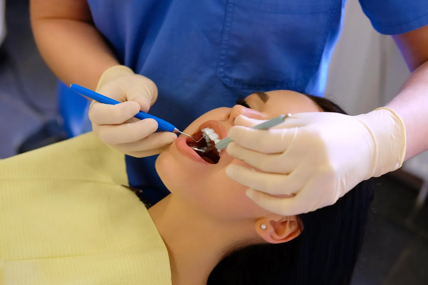 dental scaling services