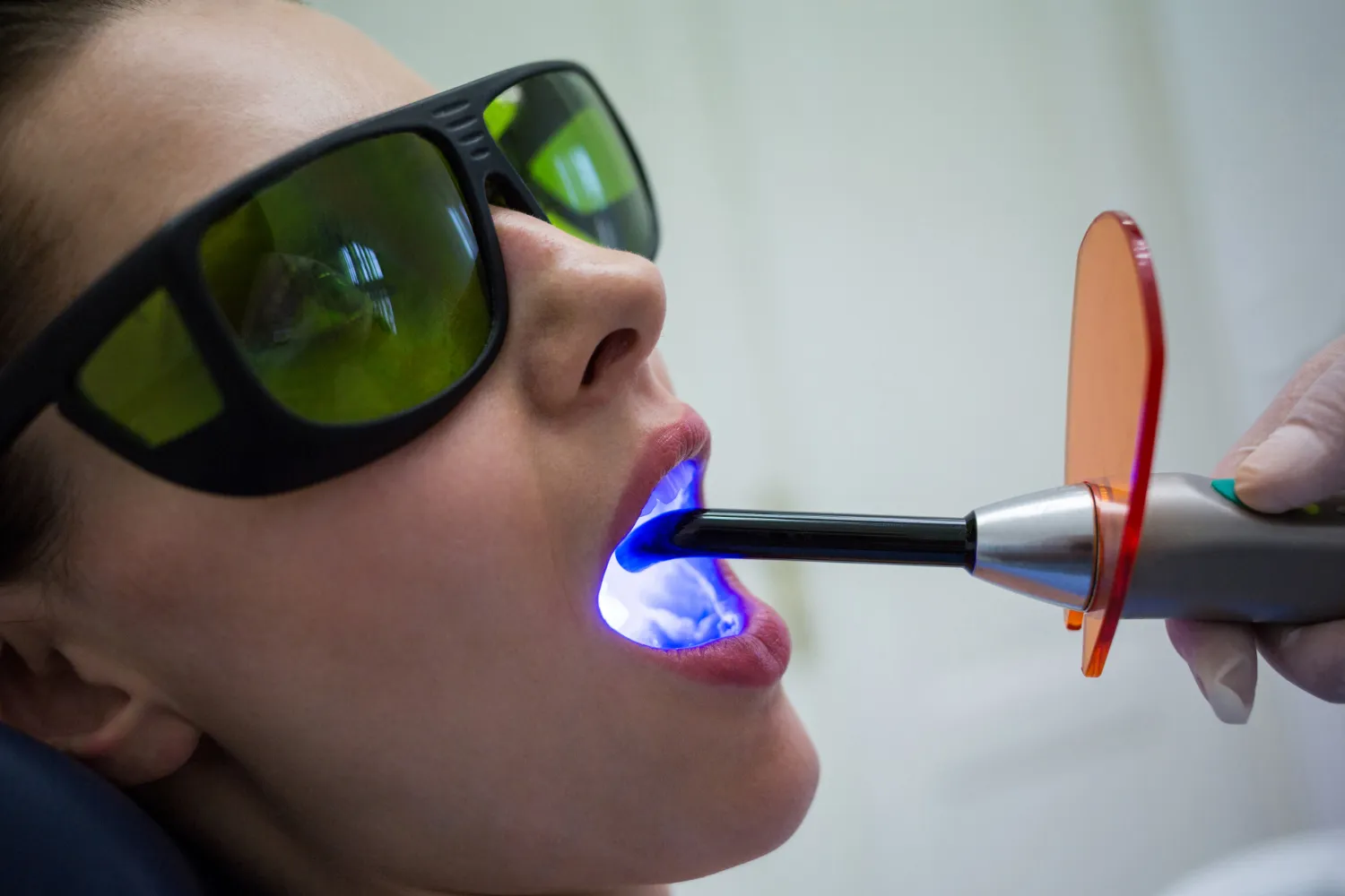 fluoride treatment at dentist