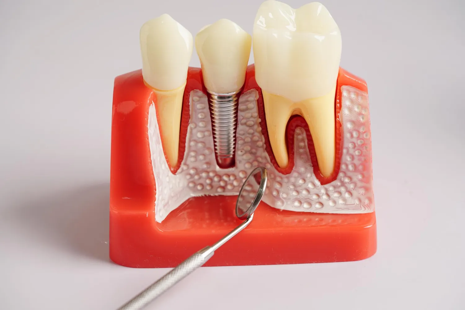 prosthodontics meaning